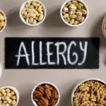 Food Allergy IgG