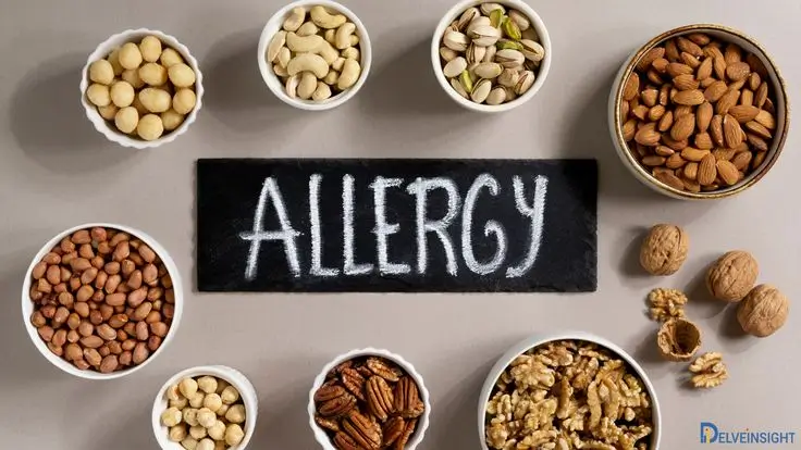 Food Allergy IgG