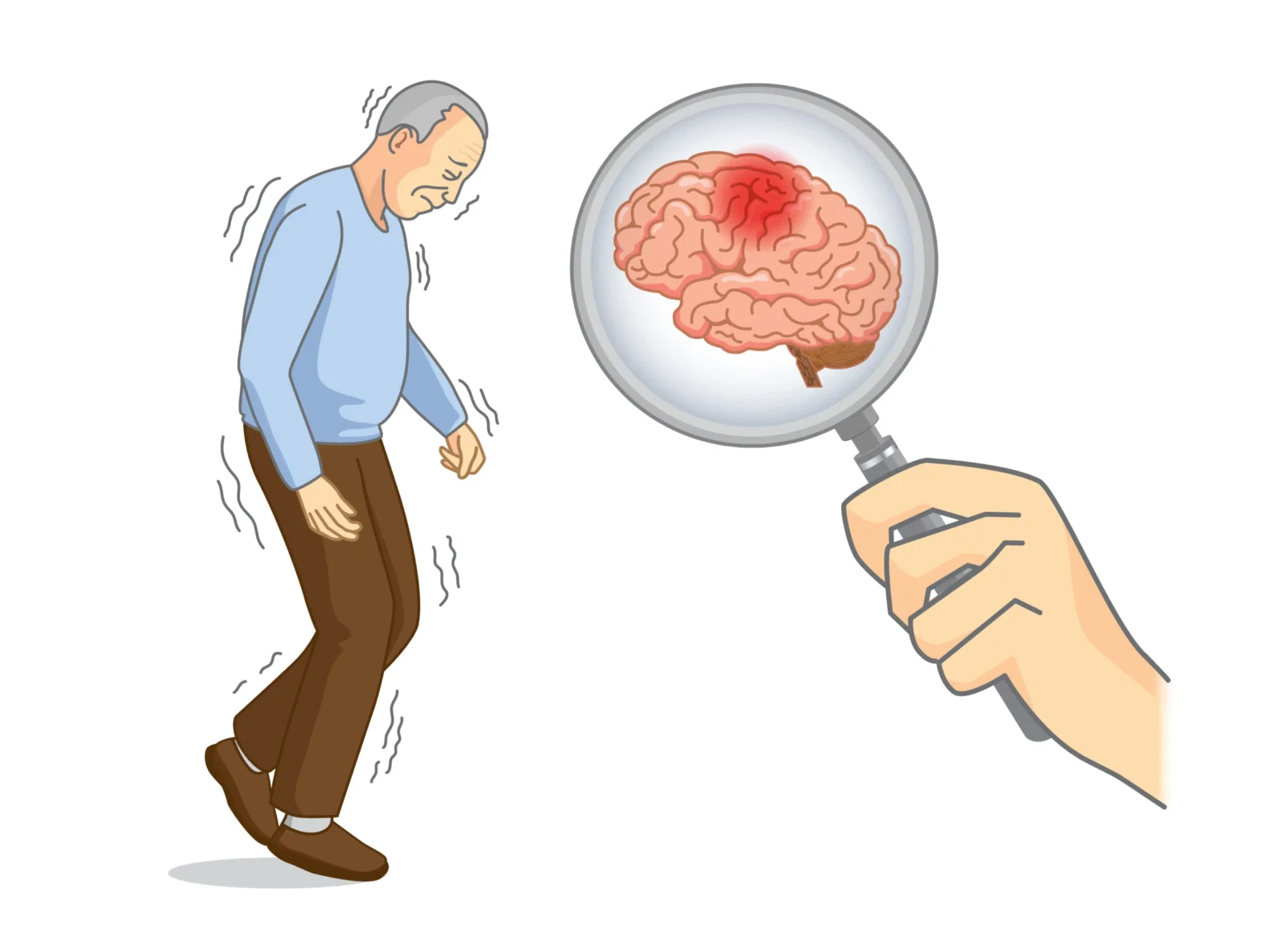 Parkinsons disease