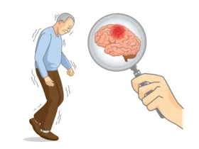 Parkinsons disease