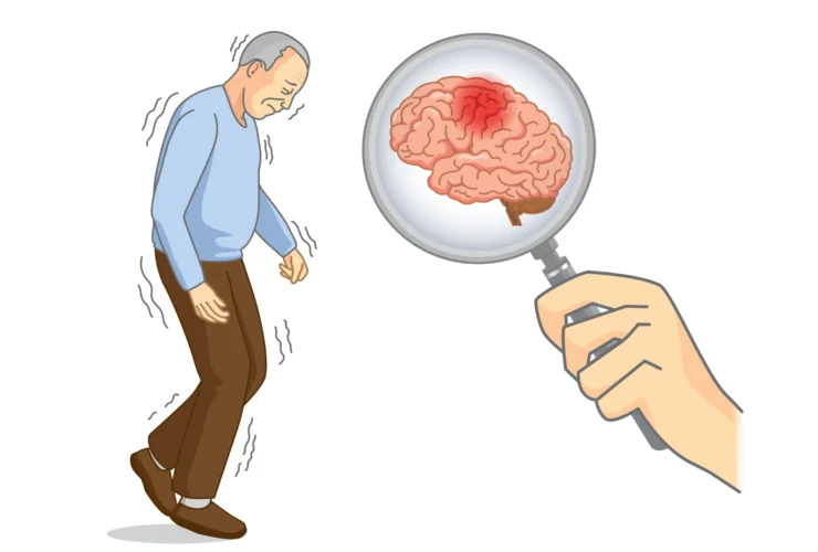 Parkinsons disease