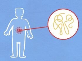 Ilustrasi usus dengan permeabilitas meningkat menunjukkan gejala leaky gut pada tubuh.
